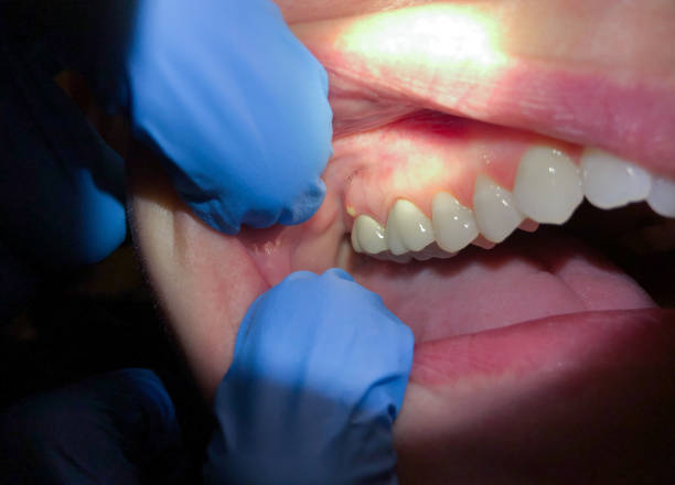 Best Emergency Cosmetic Dentistry in Farmers Loop, AK